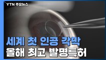 세계 첫 '인공 각막' 상용화 임박...올해 최고 발명특허 / YTN