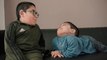 Cousins' Ultra-Rare Condition Makes Them 'Twins' | BORN DIFFERENT
