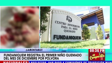 Se reporta menor quemado por pólvora en Fundaniquem