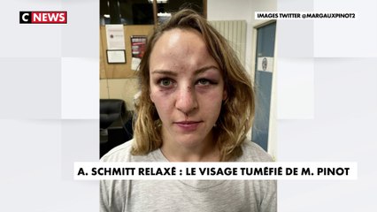 Descargar video: Alain Schmitt relaxé : Margaux Pinot dévoile son visage tuméfié