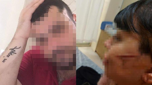Kadına dehşeti yaşattı: Önce vuruldu, sonra yüzü kesildi