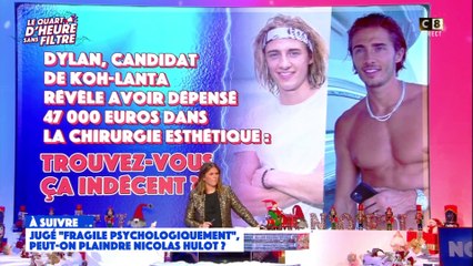 Dylan, candidat de Koh-Lanta, avoue avoir déboursé 50 000 euros en chirurgie esthétique !