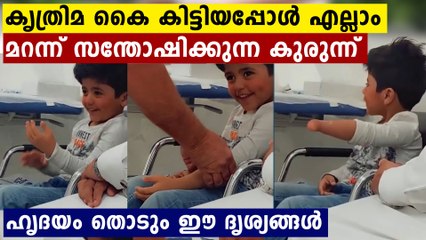 ആദ്യമായി കൃത്രിമ കൈ പിടിപ്പിച്ചു..ആരുടേയും മനം കവരും ആ പുഞ്ചിരി കണ്ടാൽ | Oneindia Malayalam