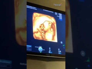 Samuel Sarmiento anuncia que se convertirá nuevamente en padre