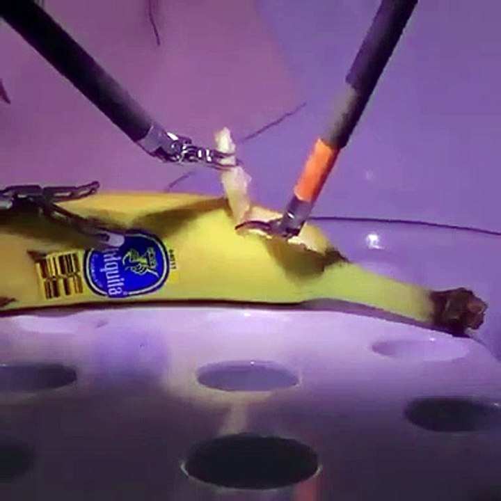 Remote Surgery using 5G