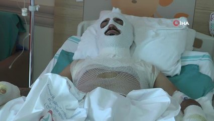 Isınmak için tenekeye tiner atınca elleri ve yüzü yandı