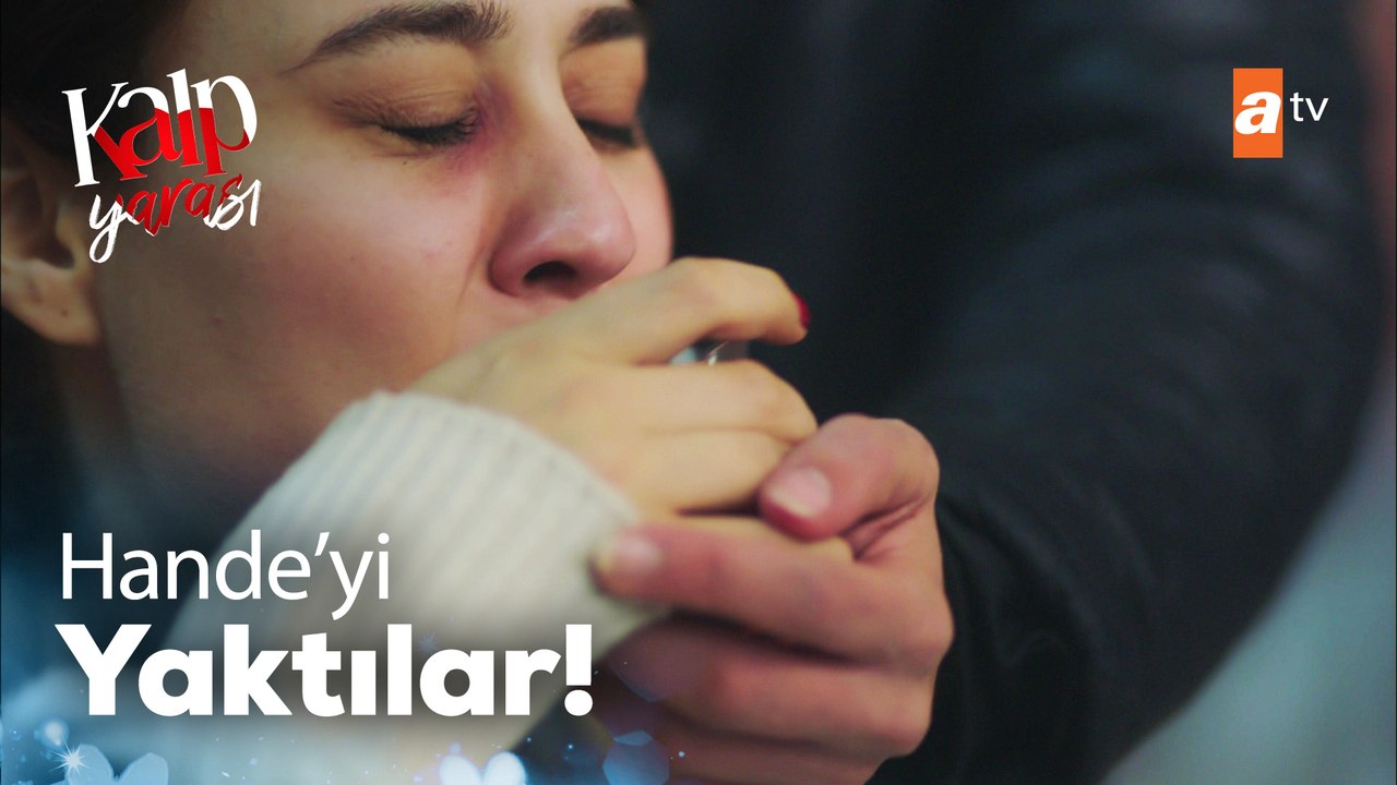 Hande'yi kaynar çayla yaktılar!  - Kalp Yarası 23. Bölüm
