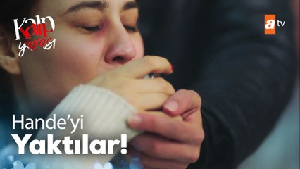 Hande'yi kaynar çayla yaktılar!  - Kalp Yarası 23. Bölüm