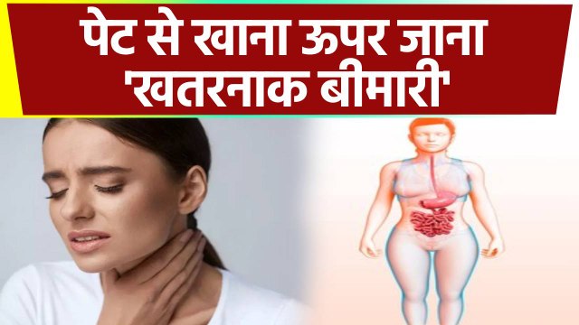 पेट से Food Pipe में खाना ऊपर आना Hiatal Hernia का Symptom, Doctors Alert | Boldsky