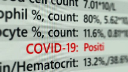 Andy Burnham press conference