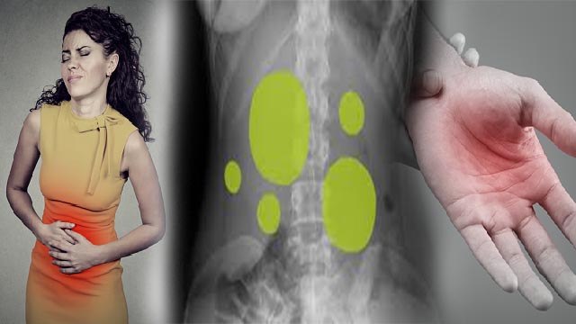 गैस का दर्द कहां कहां होता है | Gas Ka Dard Kahan Hota Hai | Boldsky