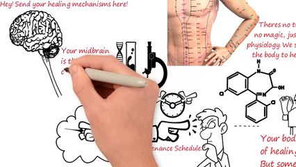 Discover How Acupuncture Naturally Heals Your Body ✨