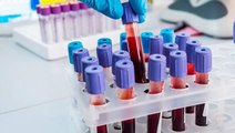 Kan grupları arasında hastalıklara karşı en dirençli kan grubu ortaya çıktı! 0 kan grubunda olanlar yaşadı