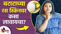 How to apply potato on face? | Get rid of dark spots |बटाटाच्या रस स्किनवर कसा लावायचा? Lokmat Sakhi