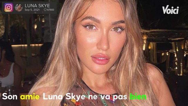 VOICI : « C'est très grave ce qu'il se passe : Simon Castaldi très inquiet pour Luna Skye hospitalisée à l'étranger pour une infection du sang