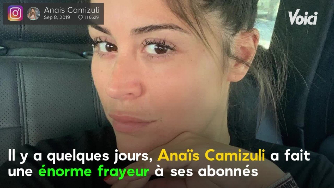 VOICI : Anaïs Camizuli hospitalisée : elle dévoile enfin de quoi elle souffre