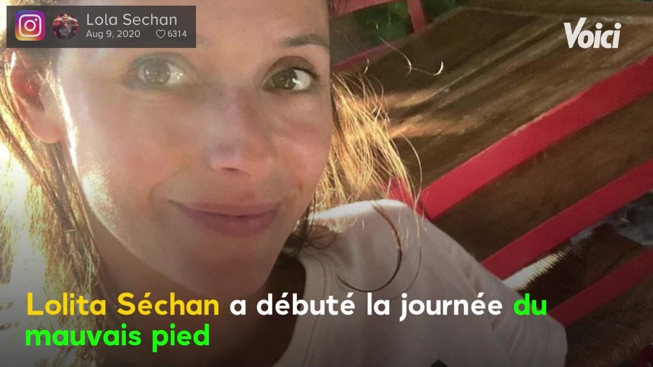 VOICI : Renaud : sa fille Lolita admise aux urgences après une attaque de son chat, elle dévoile ses blessures impressionnantes