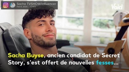 Voici -Secret Story 8 : Sacha Buyse s'offre de nouvelles fesses et diffuse l'opération sur Instagram