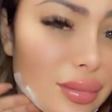 Voici SOCIAL - PHOTO Maeva Ghennam blessée au visage ? Les internautes l’accusent de mentir (1)