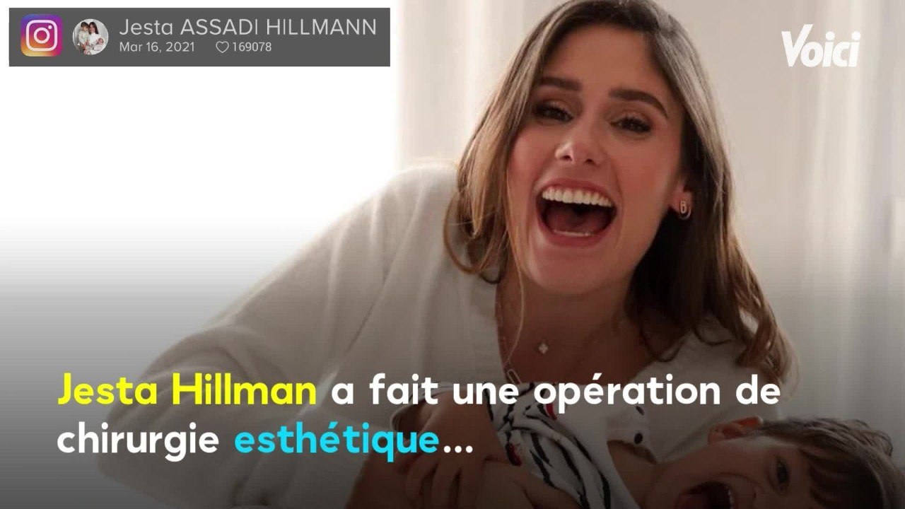 Voici - PHOTO Jesta Hillmann (Koh-Lanta) complexée : cette opération de médecine esthétique qui la rend très heureuse