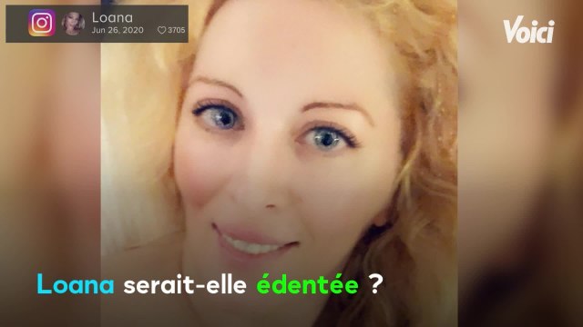 Voici - Loana édentée ? Fred Cauvin fait une nouvelle révélation choquante à son sujet