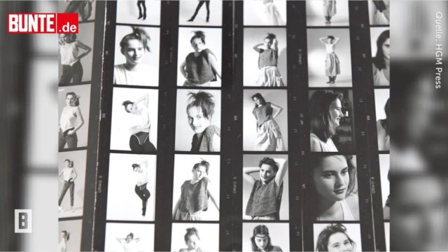 VOICI - Melania Trump méconnaissable avant la chirurgie : des photos d’elle à 17 ans refont surface