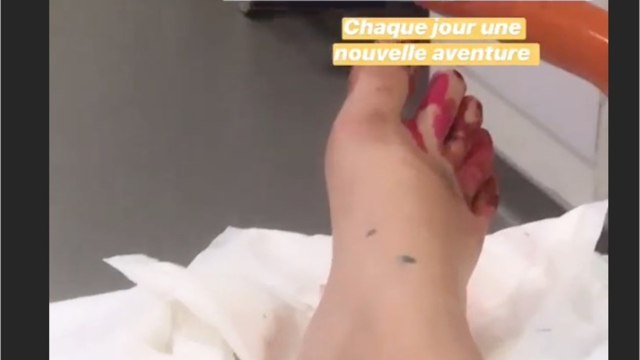 Voici - PHOTOS Marlène (Mariés au premier regard) : ce plaisir personnel qui a mal tourné et l’a conduite aux urgences