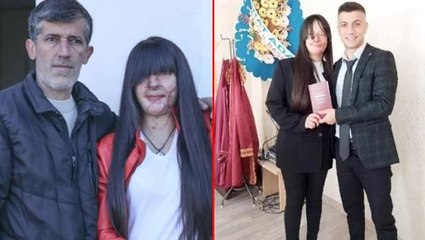 Yüzünü asitle tanınmaz hale getiren erkek arkadaşıyla evlenen Berfin babasını kızdırdı: Onu öldürmek isteyen adamla nasıl evlenir