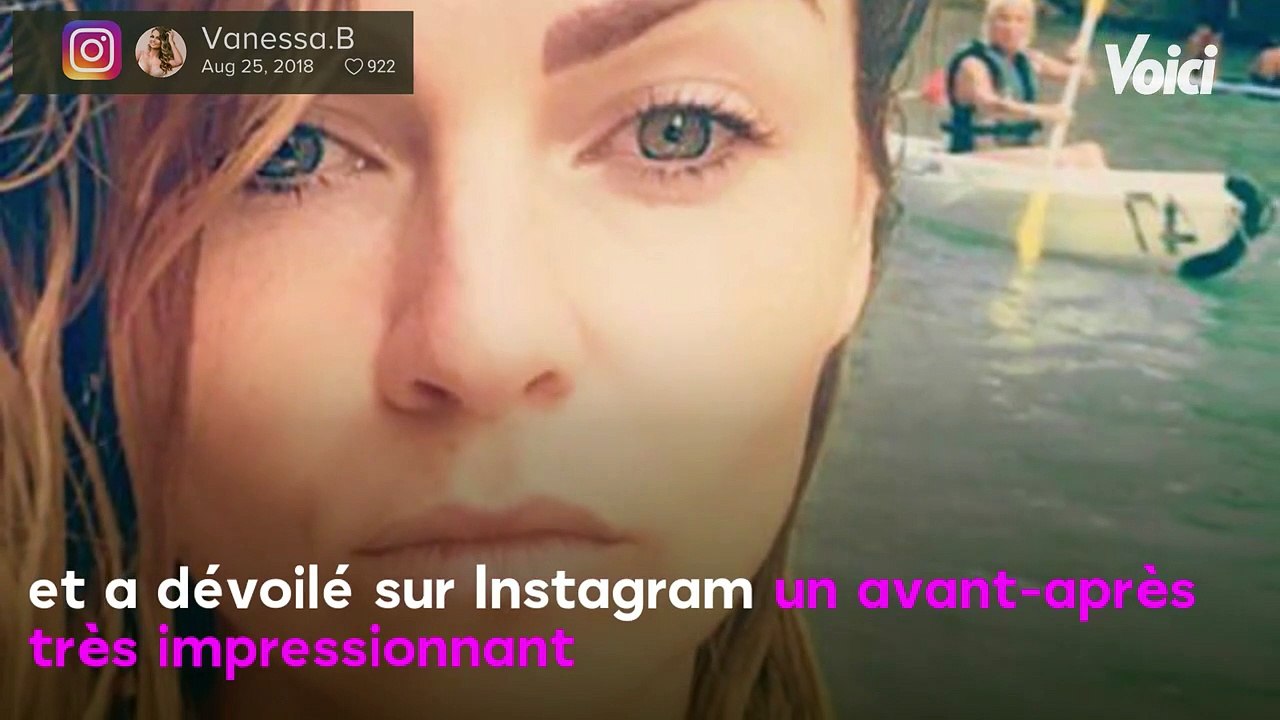 VOICI Vanessa Breckpot (Secret Story) dévoile l’avant-après de sa perte de poids, c’est bluffant