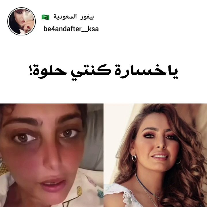 فاطمة الصفي ترد على متابعة انتقدت تغير ملامحها