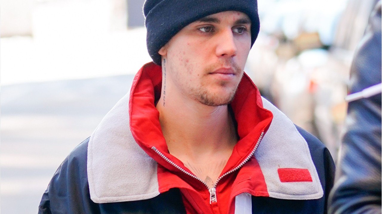VOICI-Justin Bieber révèle être atteint de la maladie de Lyme
