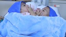 Son dakika haber | Ürdün'de başarılı operasyonla ayrılan Yemenli siyam ikizleri evlerine döndü