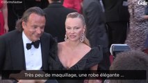 GALA VIDEO - Pamela Anderson, d'où viennent ces bleus sur ton bras ?