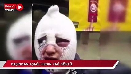 Evini bastığı eski sözlüsüne cinsel saldırıda bulunup başından aşağı kızgın yağ döktü
