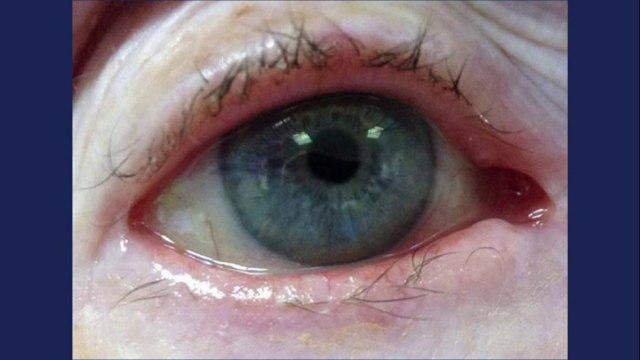 bd-cuidados-de-las-pestañas-para-mantenerlas-limpias-161221