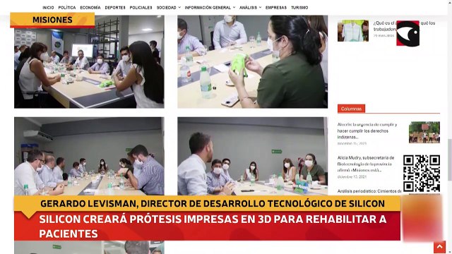 Silicon creará prótesis impresas en 3D para rehabilitar a pacientes