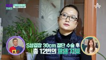 대장암 호전한 그녀의 장 건강 사수 비법 ★목도리 도마뱀 운동★