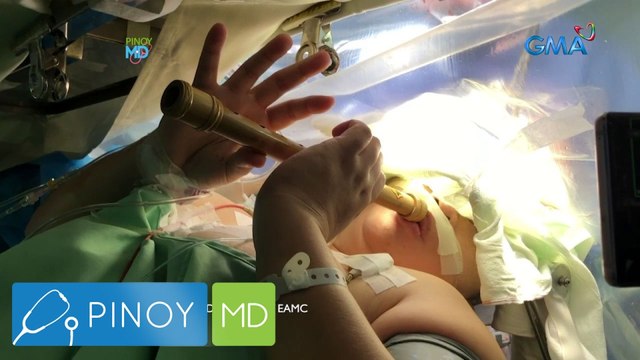 Pinoy MD: Medical breakthroughs on Pinoy MD!