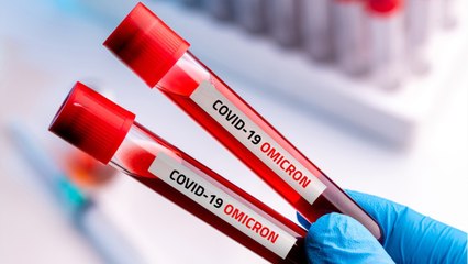 Covid-19 : mesures trop timides, contaminations records à venir..., un infectiologue alerte