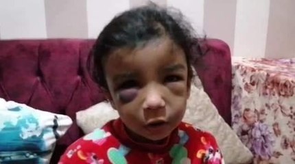 (الطفلة رودينا) النيابة حبست أب لإنه ضرب بنته ضرب مبرح (شوف عمل إيه في البنت).. صبري عثمان رئيس وحدة نجدة الطفل بالقومي للأمومة والطفولة يوضح التفاصيل