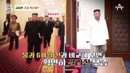 [#이만갑모아보기] 김정은이 위중하다?! 최근 김정은이 살 빠진 이유