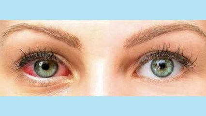 bd-tratamientos-para-evitar-ojo-seco-201221