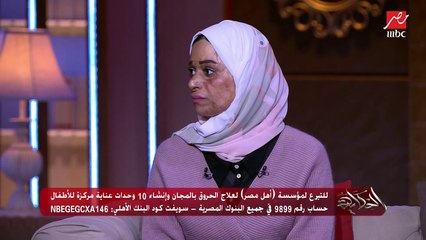 منال إحدى الناجيات من الحروق: بعد الحادثة كنت بتعالج بالبيتادين بس في مستشفى غير مجهزة والأخطاء الطبية زودت المشكلة