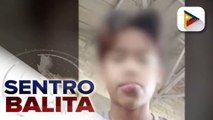 MALASAKIT AT WORK: Ginang sa Nueva Ecija, humihingi ng tulong para sa anak na may sakit sa kanyang labi