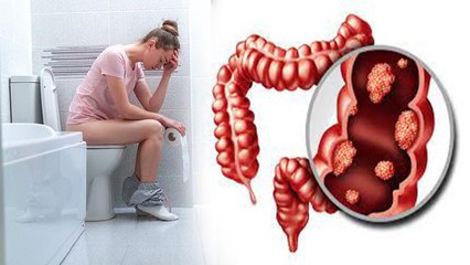 1 दिन में शौच कितनी बार जाना चाहिए | 1 Din Me Shauch Kitni Bar Jana Chahiye | Boldsky