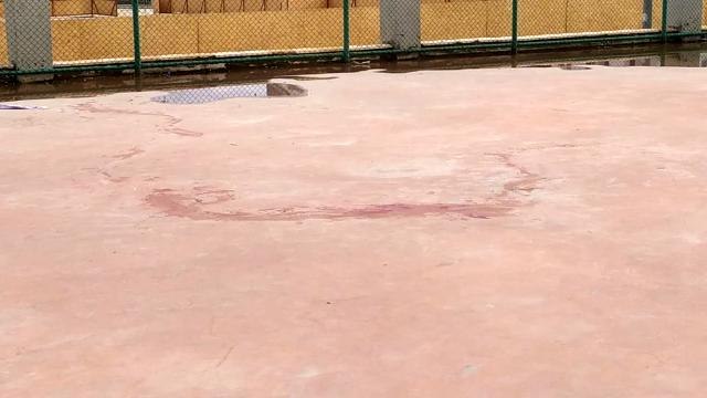 Pitbull cinsi iki köpeğin saldırdığı 4 yaşındaki kız çocuğu ağır yaralandı