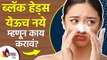 ब्लॅक हेड्स येऊच नये म्हणून उपाय | How to Get Rid of Blackheads on Face | Black Heads Treatment