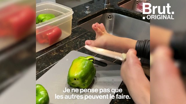 Le quotidien de Sofia, 17 ans, née sans bras