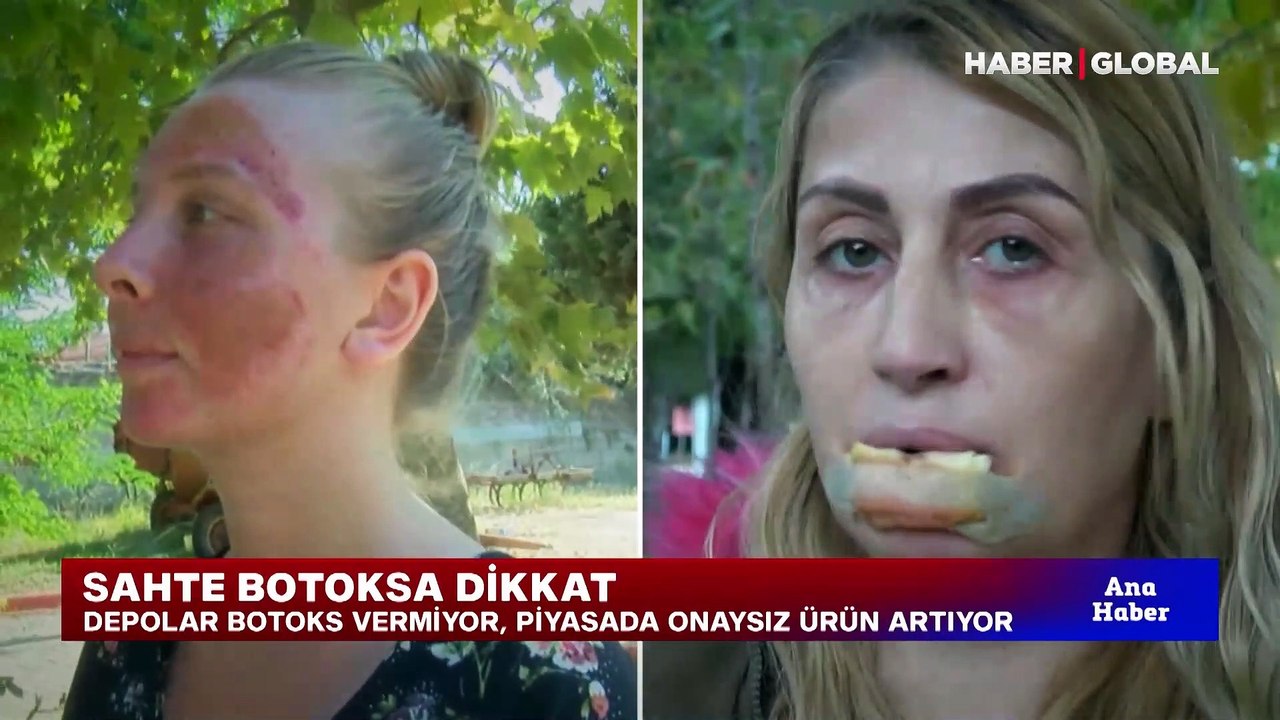 Fırsatçılar botoks stokluyor, piyasada sahte botoks ürünleri artıyor