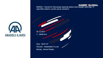 Denizli’de pitbullun saldırdığı 13 yaşındaki çocuk yaralandı